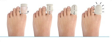 Adaptic Non-Adherent Digit Dressing