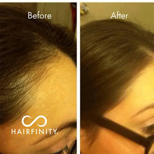 Infinite Edges Serum - 15ml Hairfinity